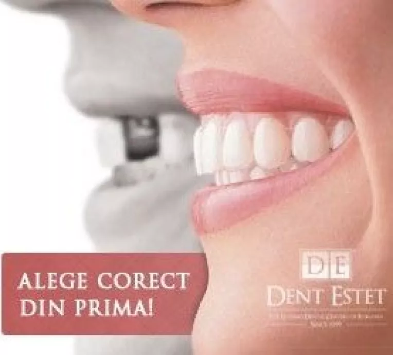 Adevarat sau fals: Mituri despre implantul dentar